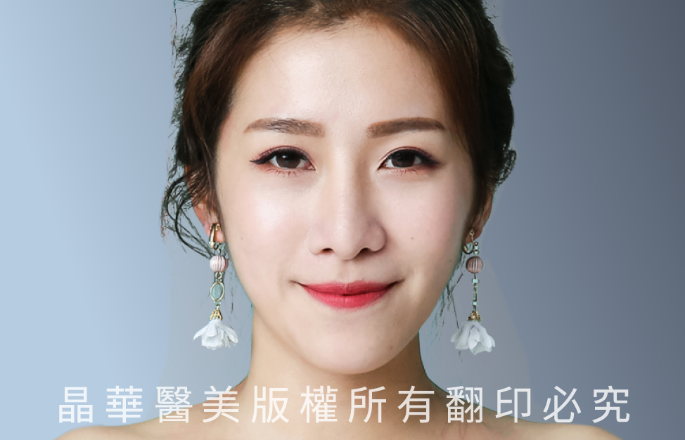 台北、桃園晶華醫美眼袋整形手術推薦 眼袋術後照片
