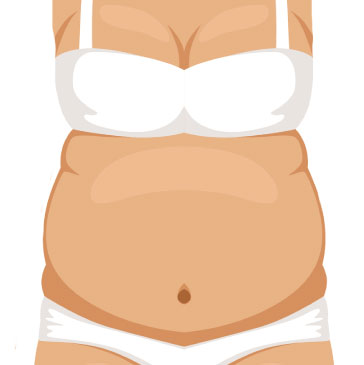 腹部小腹好難瘦？晶華醫美抽體體雕手術幫你進行腹部抽脂！