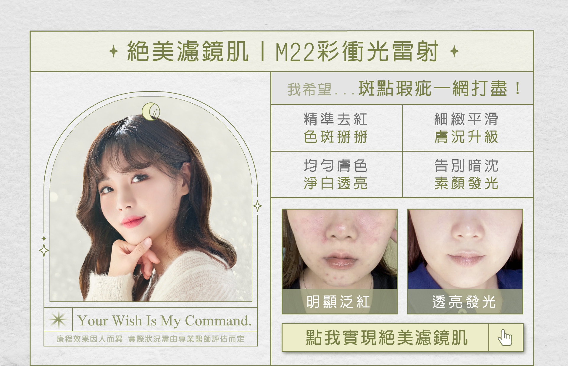 聖誕節約會醫美療程推薦-M22脈衝光雷射