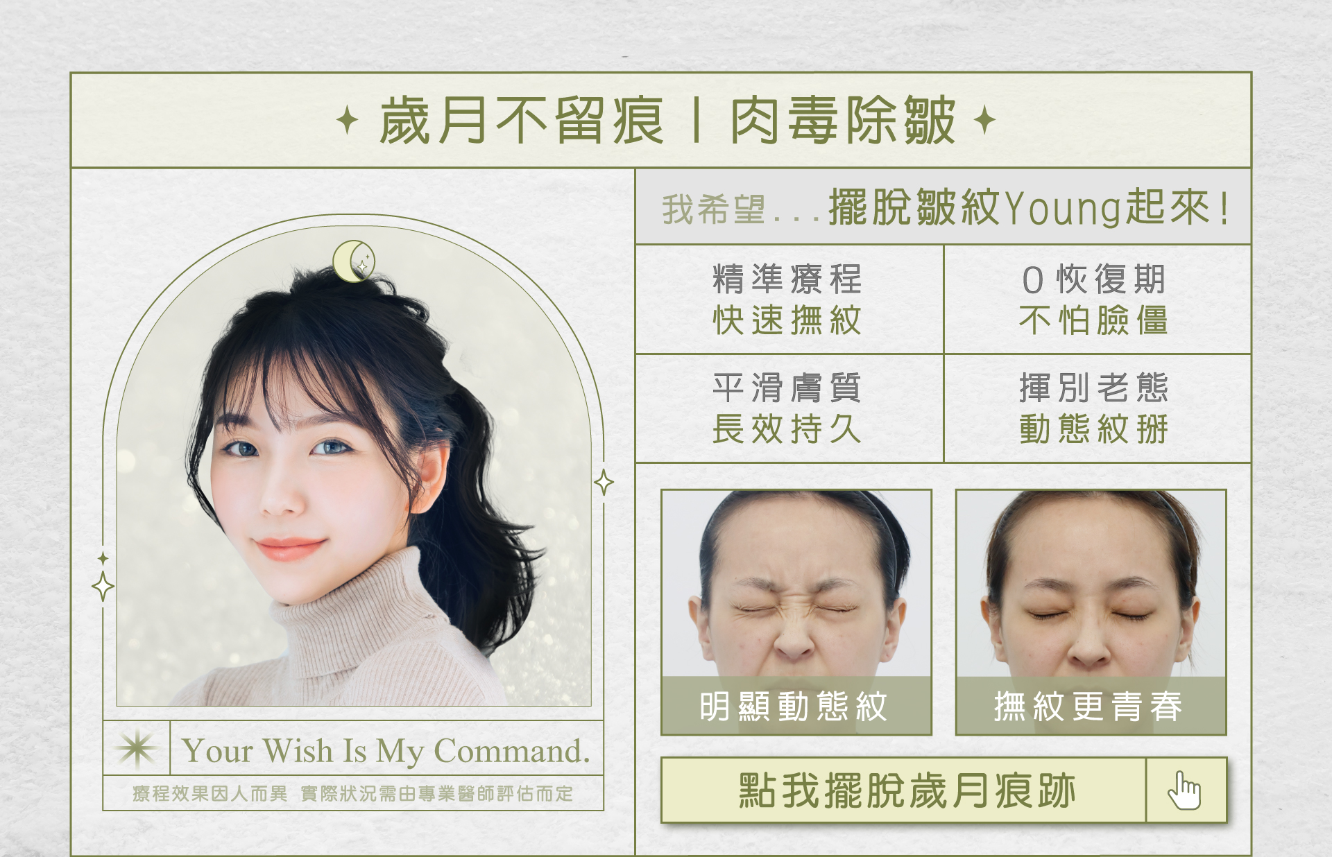 聖誕節約會醫美療程推薦-肉毒桿菌素除皺紋